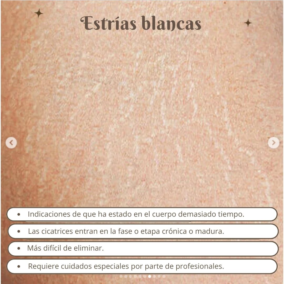 CIARA: Adiós a las estrías 001